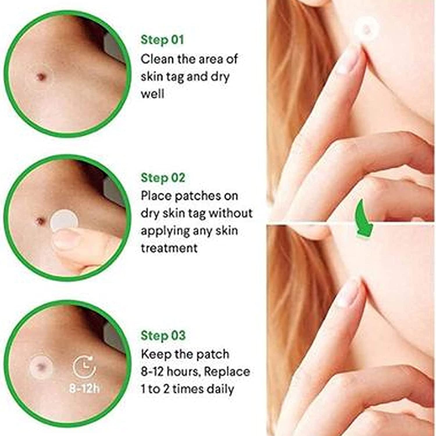 SKIN TAG ACNE PATCH DOTS (36 DOTS)