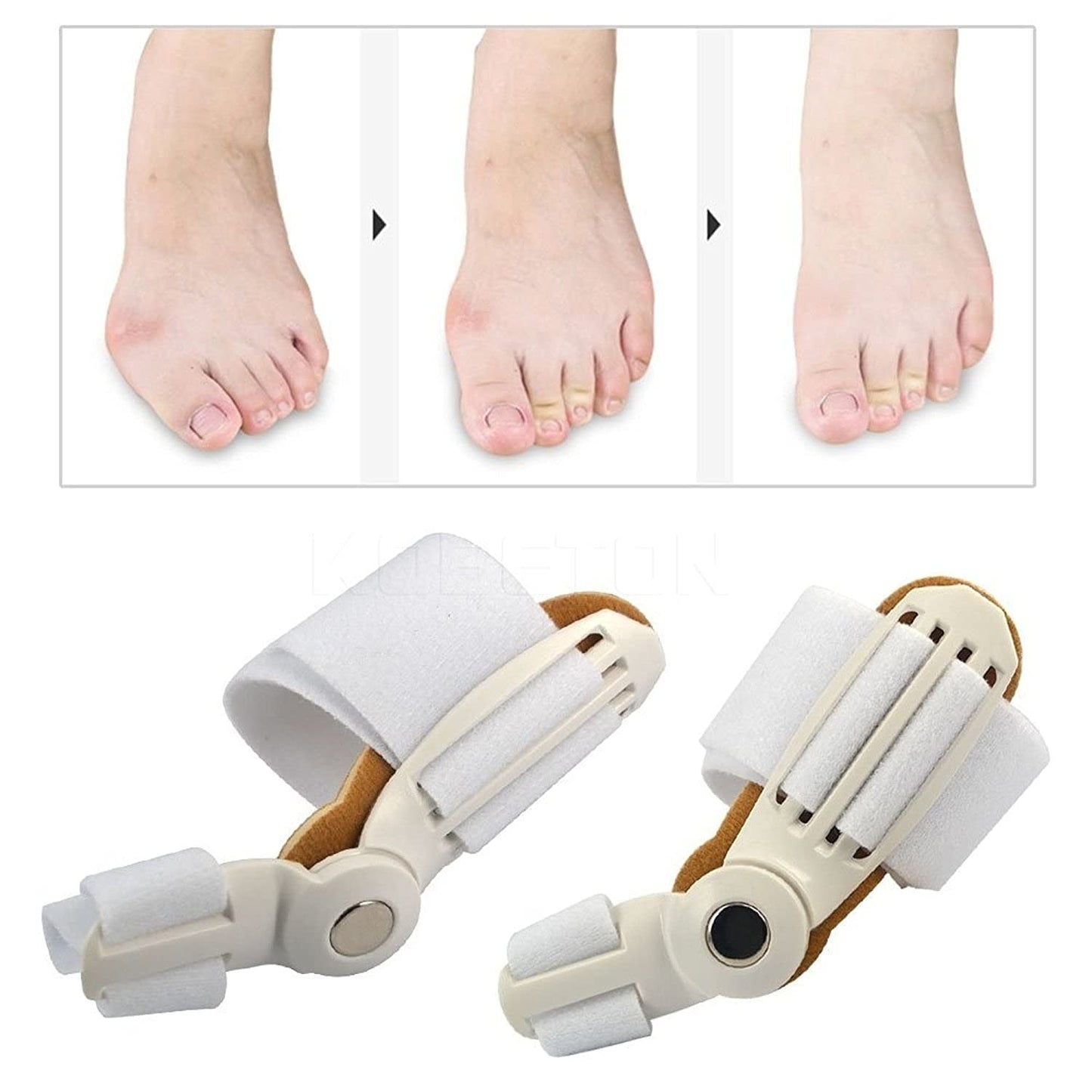 Toe Straightener