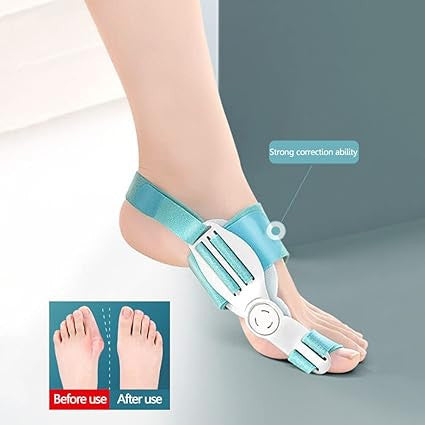 New Toe Straightener