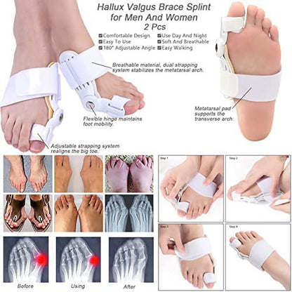 Toe Straightener