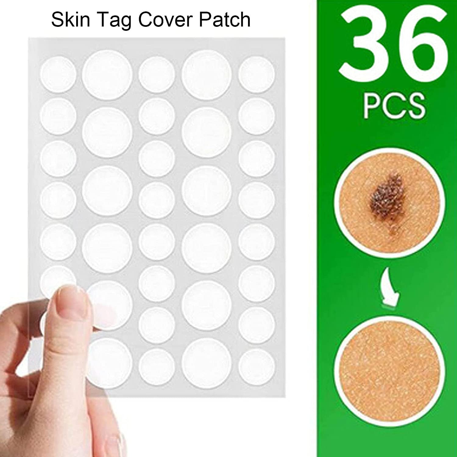 SKIN TAG ACNE PATCH DOTS (36 DOTS)